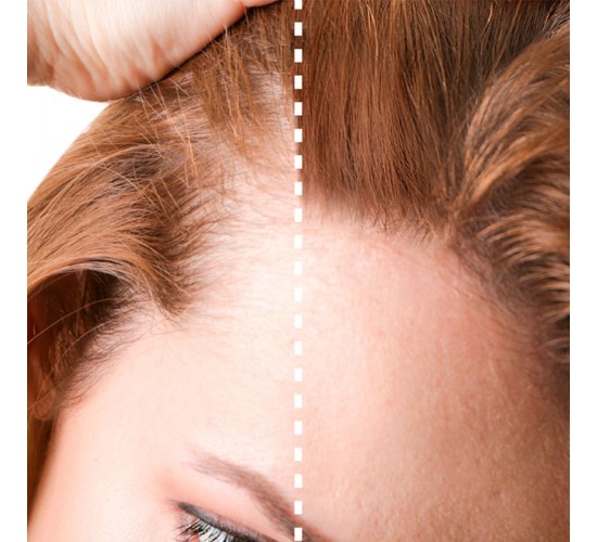 Fibras capilares para cabello fino y débil